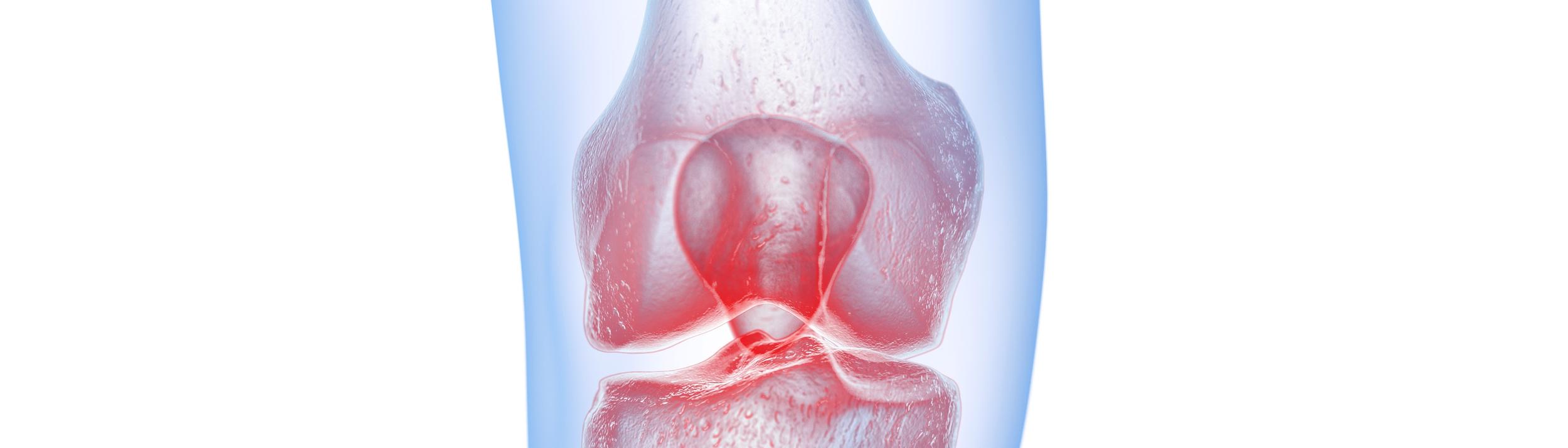 Cover Image for Calendar