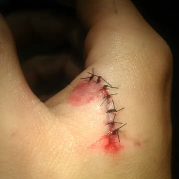 Cover Image for Anatomy and Physiology for Biohackers - Open Registration