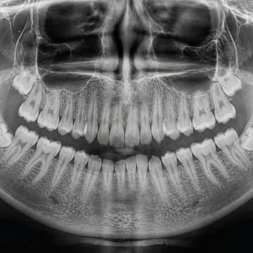 Cover Image for How To Read a Dental X-Ray