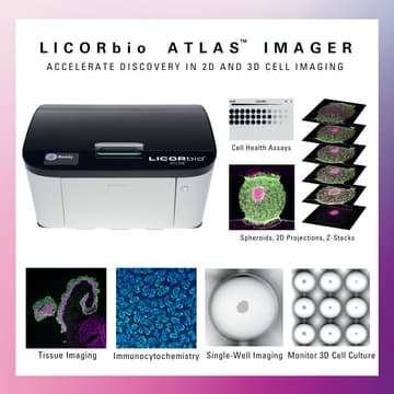 Cover Image for Smarter, Faster Cell Imaging with the Licorbio Atlas™: Unlocking High-Content 2D & 3D Assays