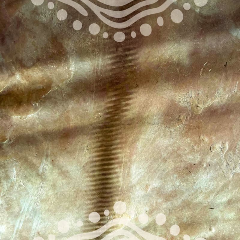 Cover Image for DILATION