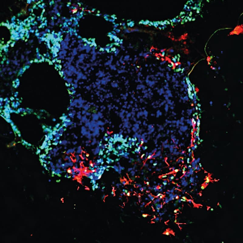 Cover Image for Workshop on Culturing Cerebral Organoids