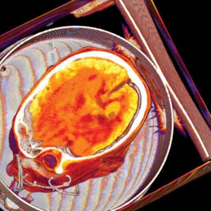 Cover Image for The Science of “Social Atrophy” and what Isolation Does to the Brain