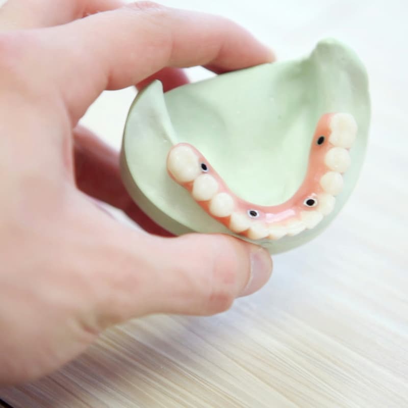 Cover Image for Dental Days and Impression Days