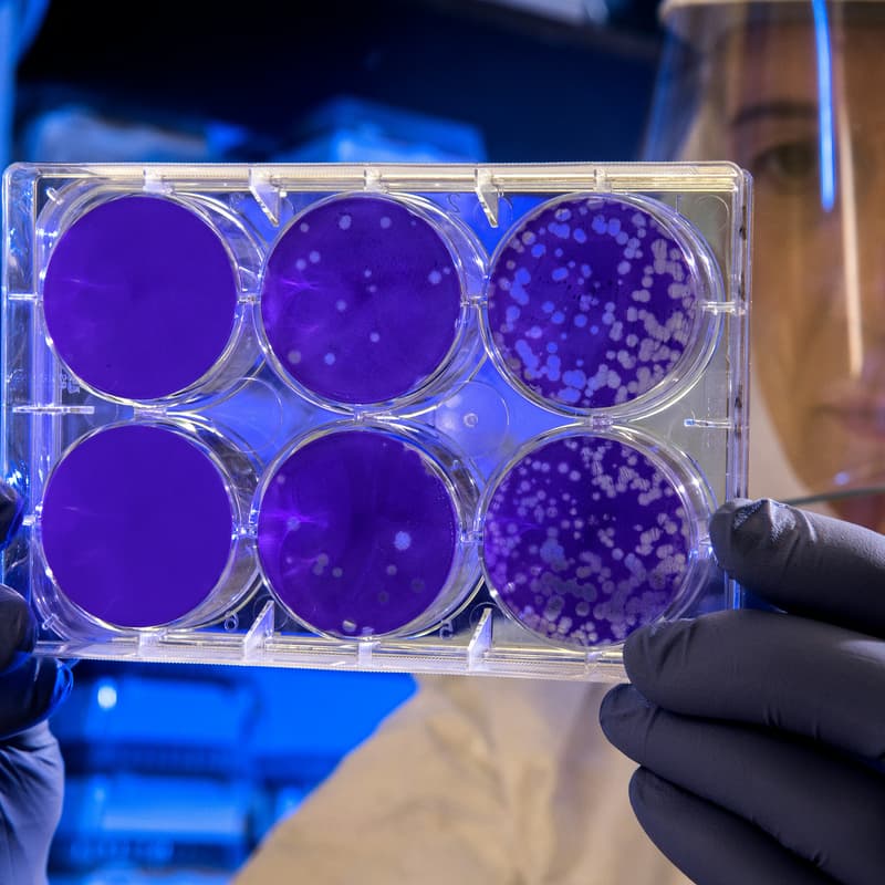 Cover Image for Prioritizing Biological Risks: The Case for AMR
