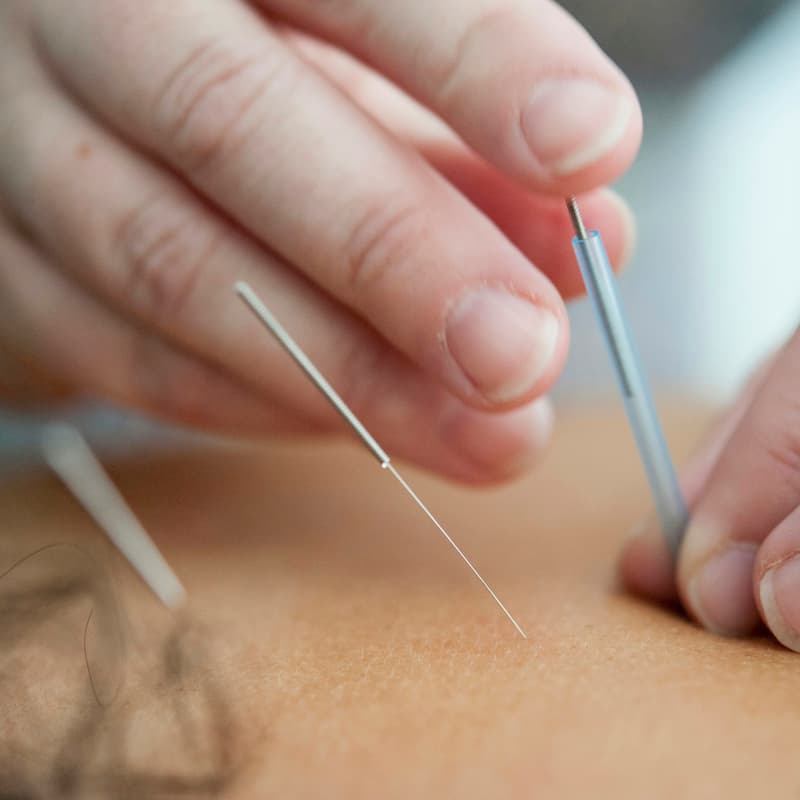 Cover Image for Using Acupuncture To Treat Mental Disorders: Feasilility And Effectiveness 针灸治疗精神类疾病的可行性和有效性
