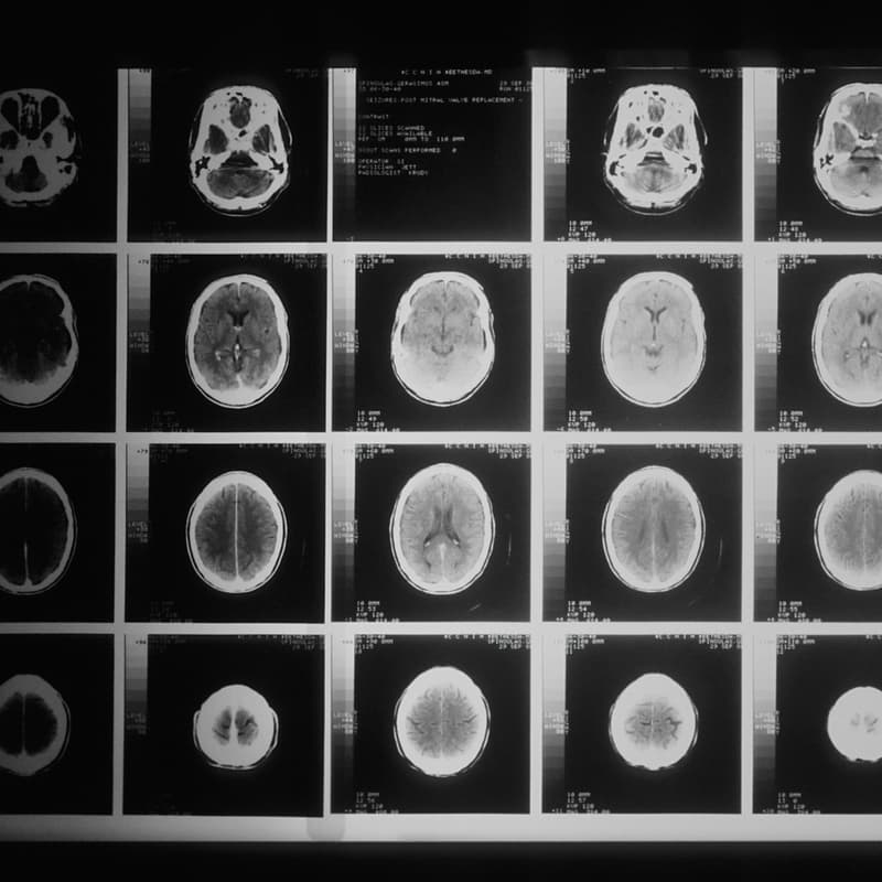 Cover Image for Reading, Modelling and Modulating the Brain