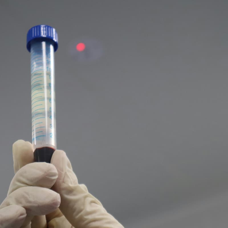 Cover Image for Normal Is Not Optimal: The 12 Biomarkers You Should Have Checked Yesterday