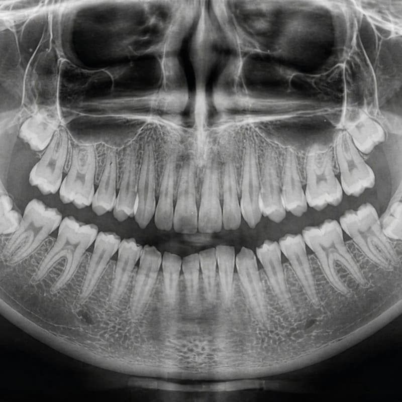 Cover Image for How To Read a Dental X-Ray