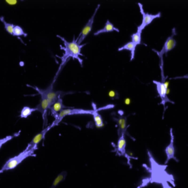 Cover Image for See what your cells are telling you about your compounds [SBC x Sentinal4D x Revvity]