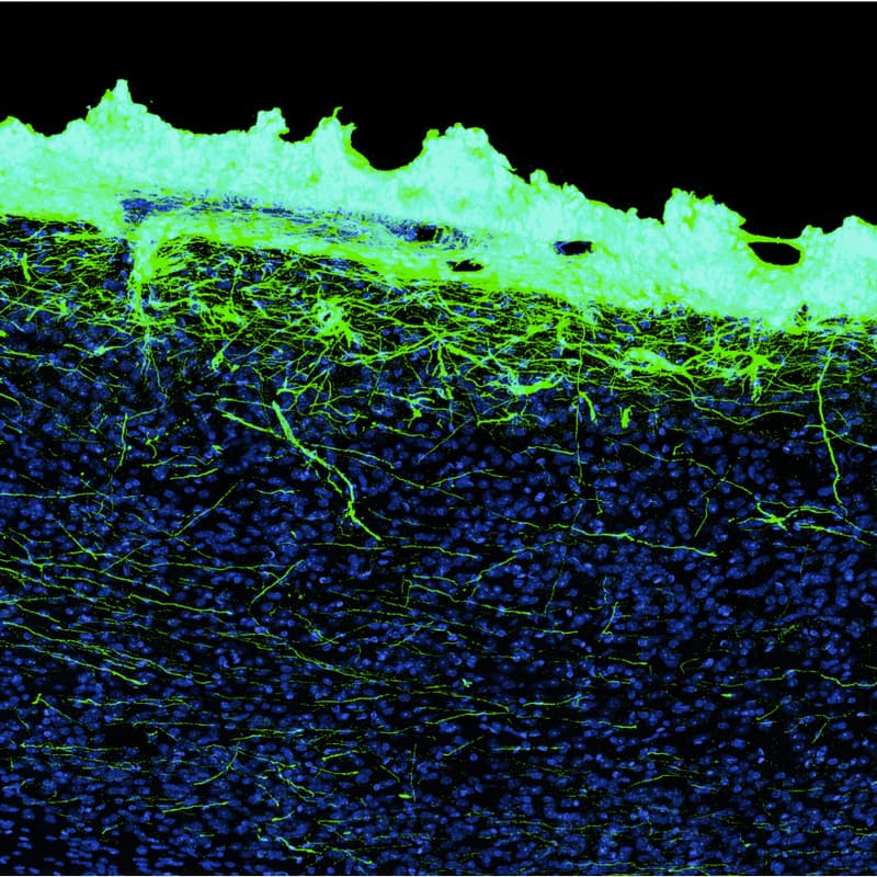 Cover Image for NeuroNYC presents Biohybrid BCIs with Science Corporation