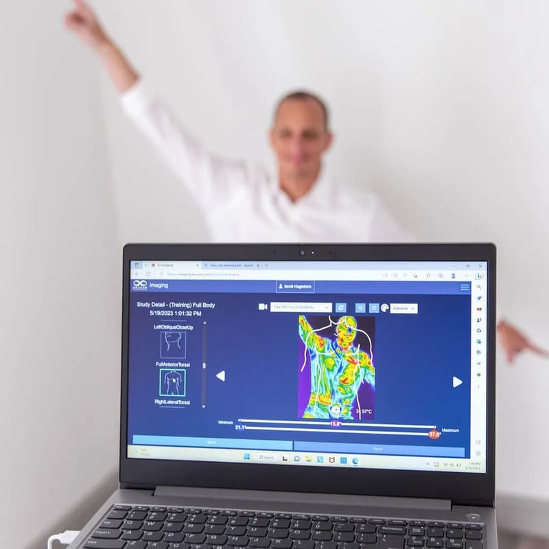 Cover Image for Next Health Longevity Social:Thermograghy