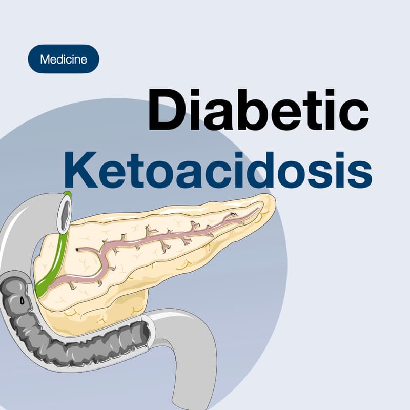 Cover Image for Diabetic Ketoacidosis (DKA)