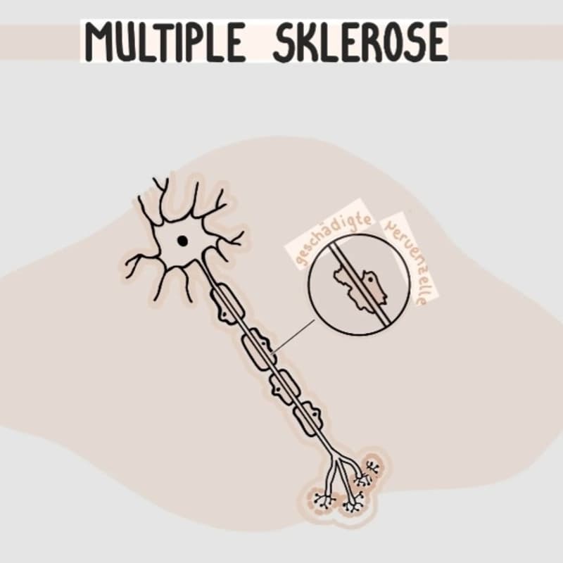 Cover Image for Multiple Sklerose