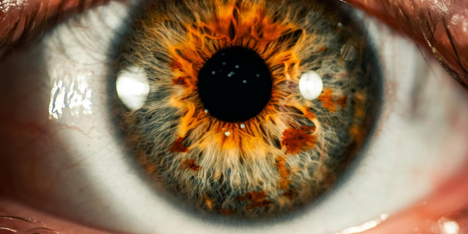 Cover Image for Ophthalmology ST1 Portfolio Workshop 2022-2023 